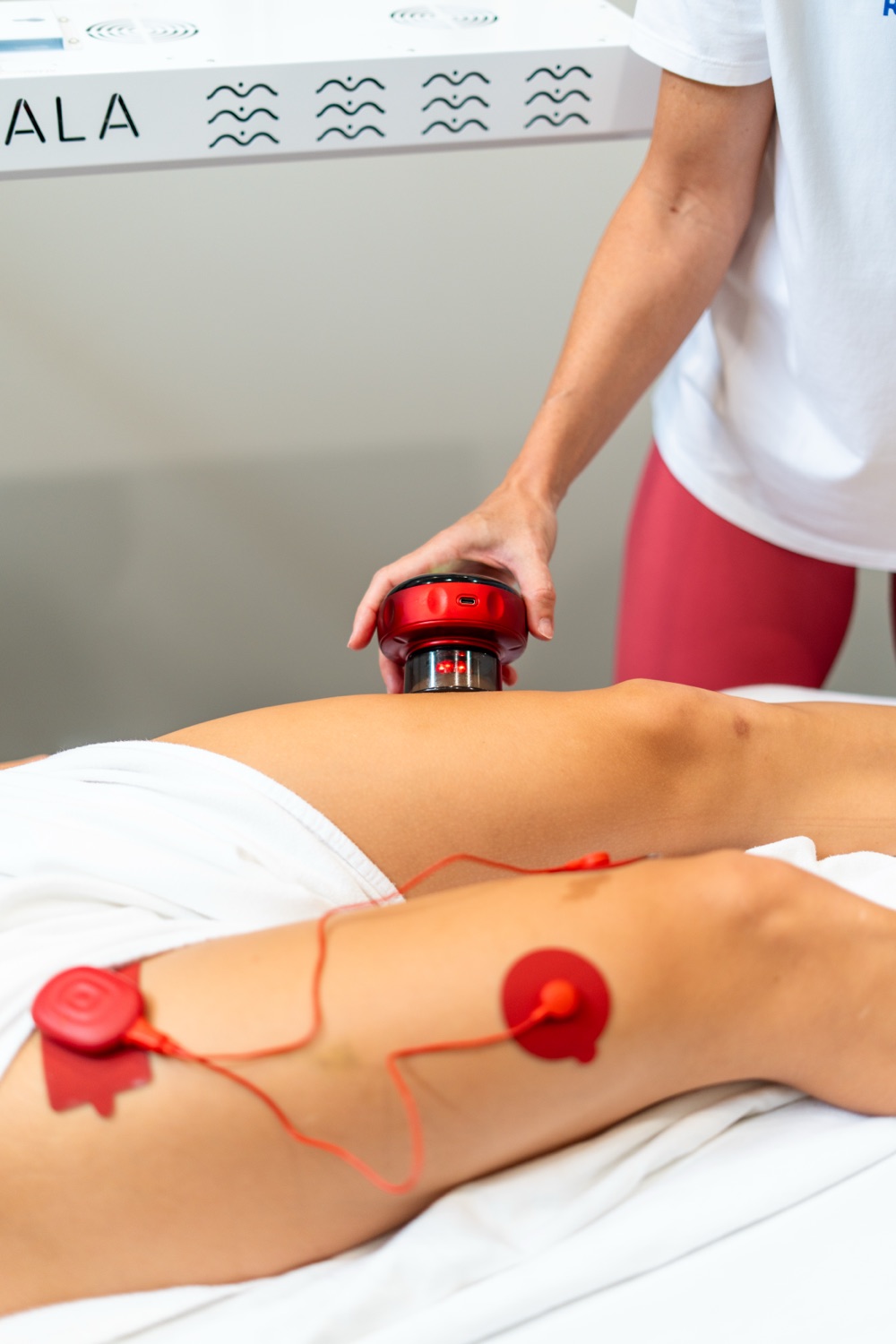Neurofunctional Acupuncture