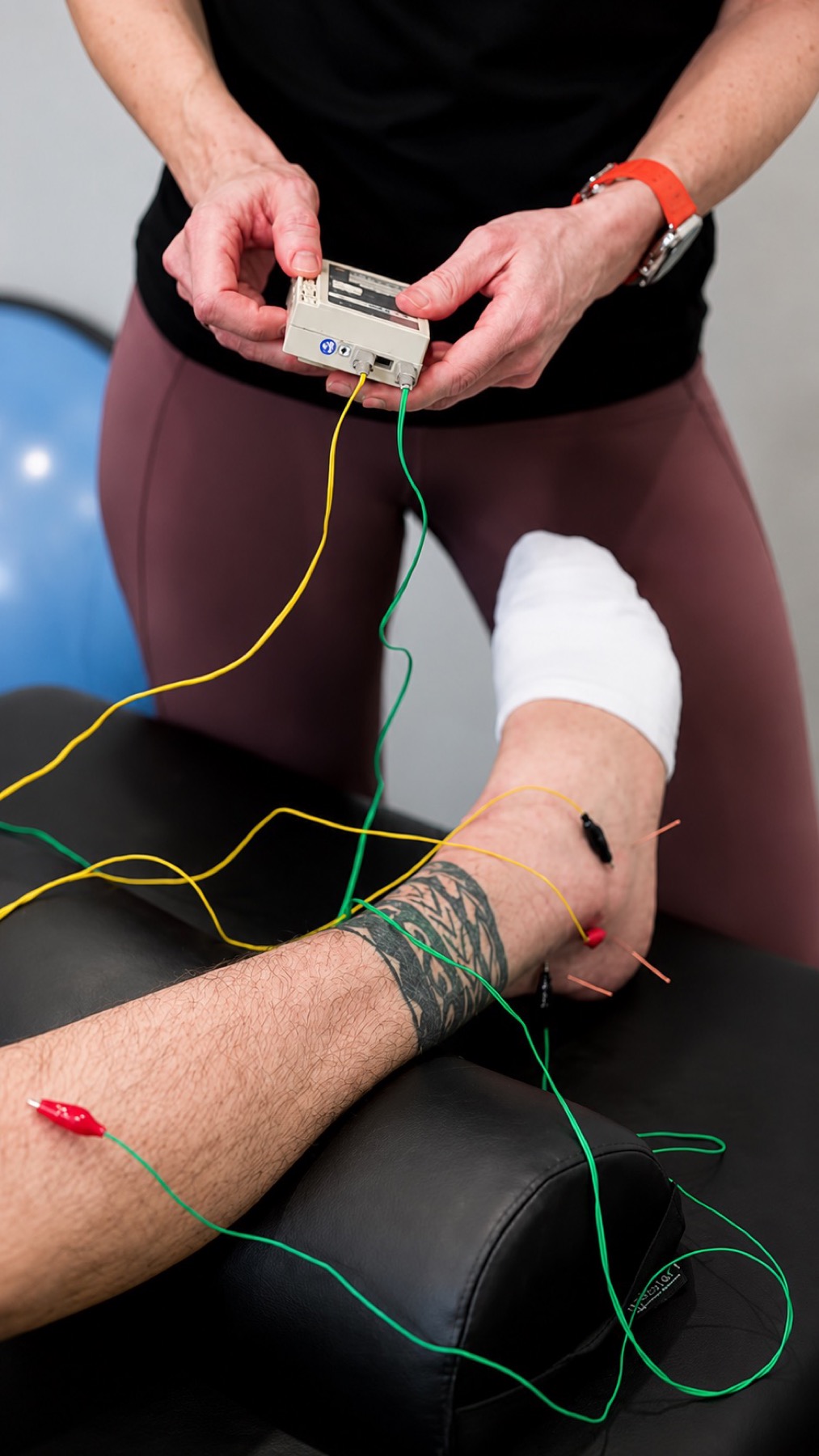 Neurofunctional Acupuncture
